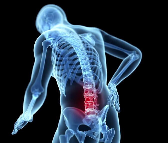 Tischtennis Leonding | Böger-Therapie. Wirksame Hilfe bei Lösung von körperlichen Einschränkungen Digitale Illustration eines Menschen mit hervorgehobenem Schmerzbereich im unteren Rücken.